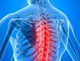 a mellkasi gerinc osteochondrosisának kezelése kenőcs a bokaízület artrózisa 2 fok